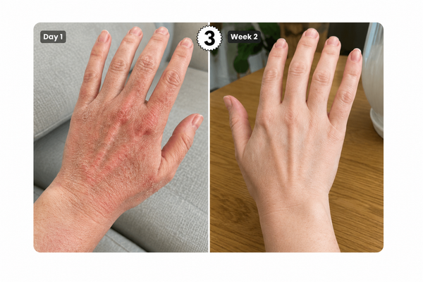 Problem: Dull, Tired-Looking Skin