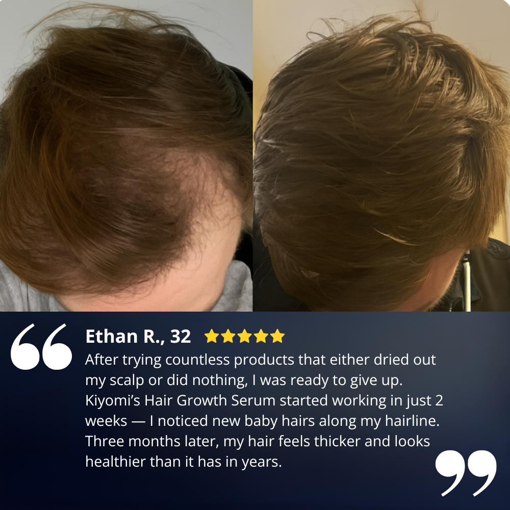 Kiyomi Hair Growth Serum Roll-On